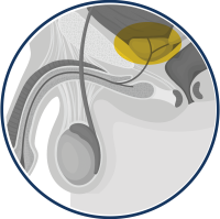 Prostate