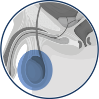 Testicule